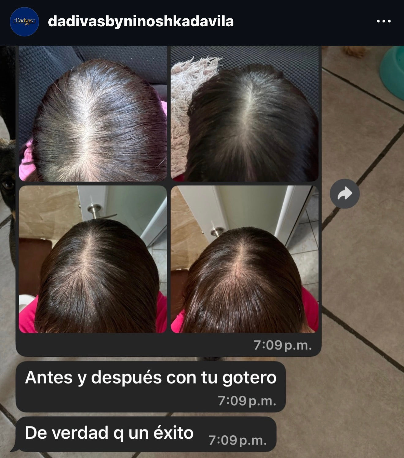 Gotero de crecimiento.